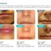 REVOFIL PLUS